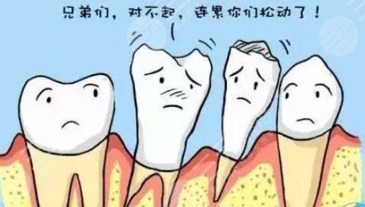种植牙能够维持多久