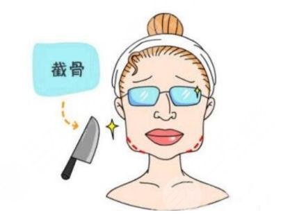 下颌角整形