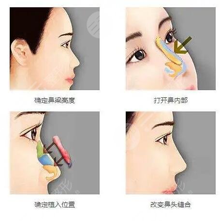 南方医科大学南方医院整形美容外科擅长项目