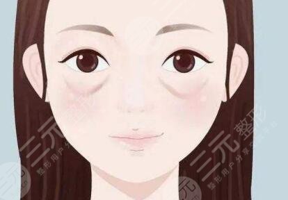双眼皮