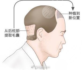 郑州大麦微针植发医院环境图