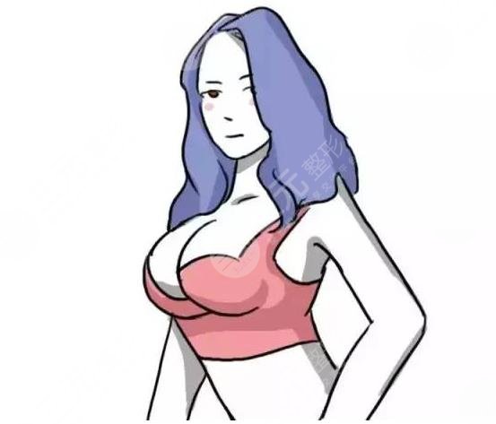 隆胸项目科普