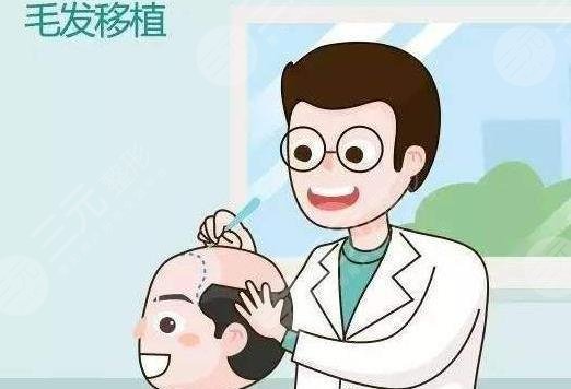 前额植发手术