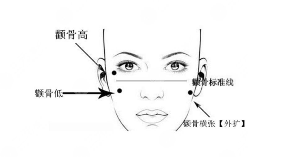 上海九院整形科面部整形案例