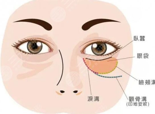 上海祛眼袋医院哪家好?(三甲公立专栏)上海九院再次领衔众医院 上海祛眼袋医院哪家好?(三甲公立专栏)上海九院再次领衔众医院