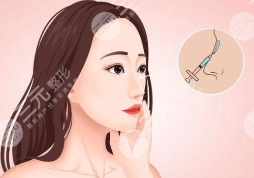 膨体隆鼻可以一辈子不取出来吗?有什么优缺点?美鼻攻略大全~ 膨体隆鼻可以一辈子不取出来吗?有什么优缺点?美鼻攻略大全~