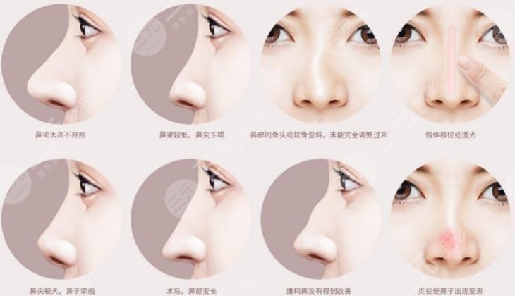 秦皇岛市第一医院整形美容科科普小课堂来啦~