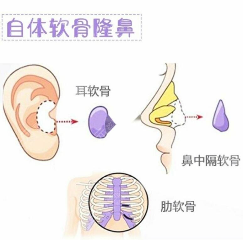 合适的材料