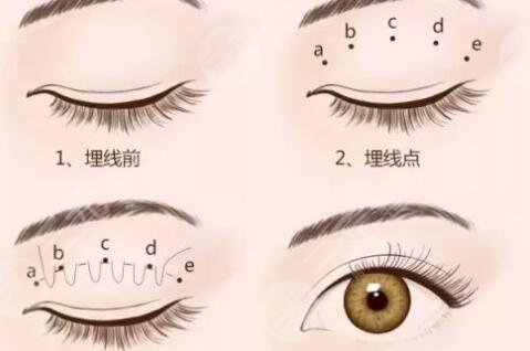 上海9院整形科项目科普