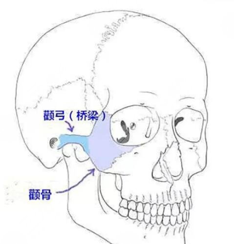 磨骨成好吗