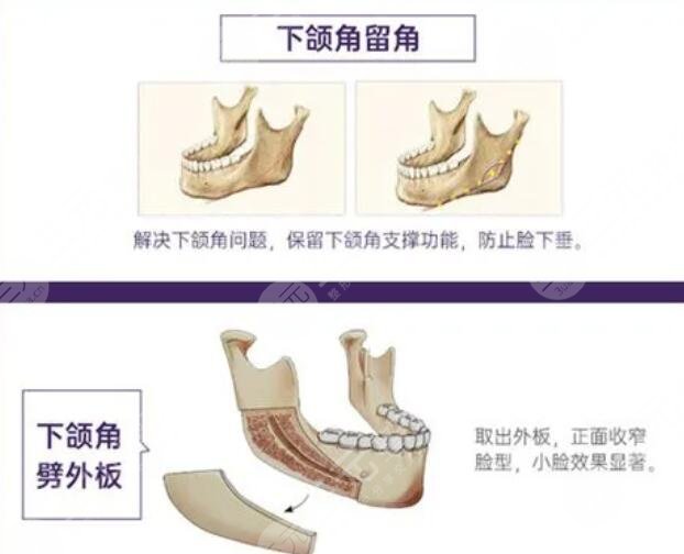 磨下颌骨