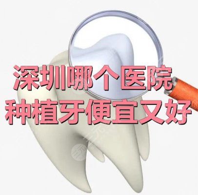 深圳哪个医院种植牙便宜又好?美莱口腔&美奥口腔&乐莎莎口腔等机构P 深圳哪个医院种植牙便宜又好?美莱口腔&美奥口腔&乐莎莎口腔等机构P