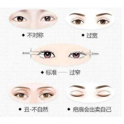 东营艺美医疗整形医生关于双眼皮手术失败怎么办相关问答：