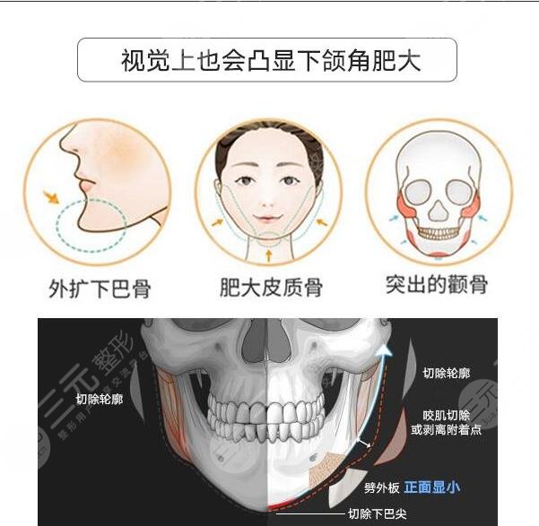 磨骨手术的风险是什么