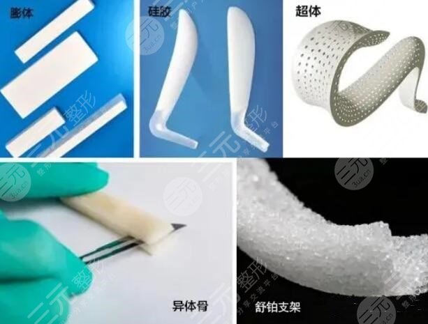 假体隆鼻后出现包膜挛缩怎么办