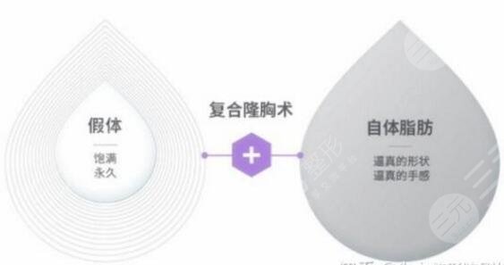 北京联合丽格第一医疗美容医院科普复合隆胸
