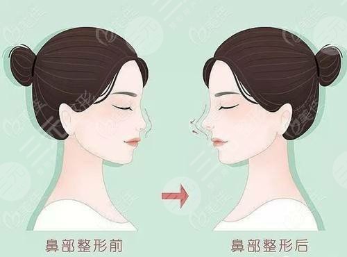 北京新美荟医疗美容诊所怎么样