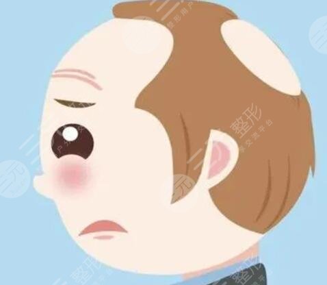 莆田新生植发医院秃顶植发案例