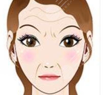 激光除皱抗衰治疗后容易留下疤痕吗