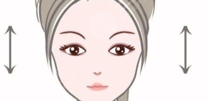 广州圣诺达医疗美容医院全切双眼皮案例