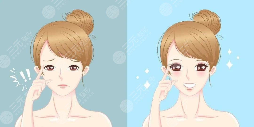 广州汇美集团双眼皮案例