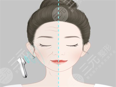 加减美整形医院V美减龄案例