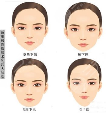 郑州美莱整形医院V-line瓜子脸手术科普