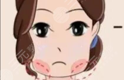 雅美整容怎么样