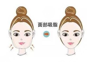 中国医学科学院北京协和医院整形手术经历分享