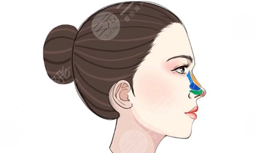 沈阳名流美容医院隆鼻怎么样?网友:闵英俊和袁继龙技术不容小觑,不会踩坑 沈阳名流美容医院隆鼻怎么样?网友:闵英俊和袁继龙技术不容小觑,不会踩坑