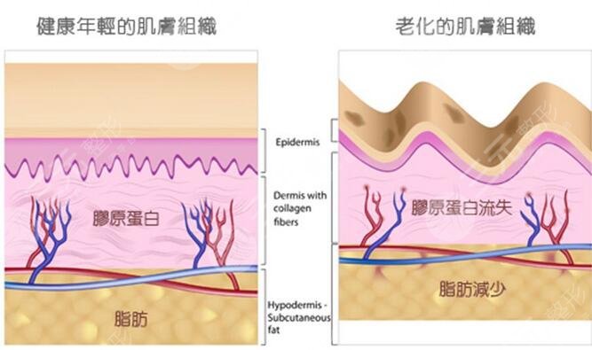 手上皮肤松弛
