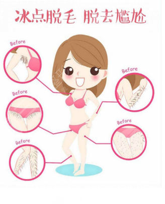 上海九院脱毛挂什么科?脱毛科普