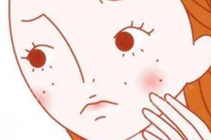 北京艺美整形医院光子嫩肤案例