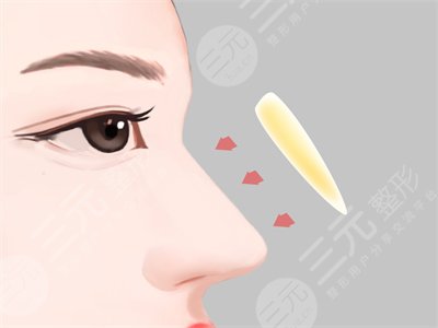熊瑛医生