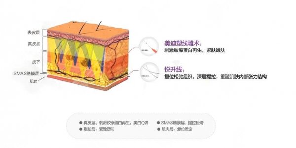 杭州薇琳做的悦升线怎么样？整形医院口碑_坐诊专家_收费预览