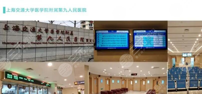 上海第九人民医院