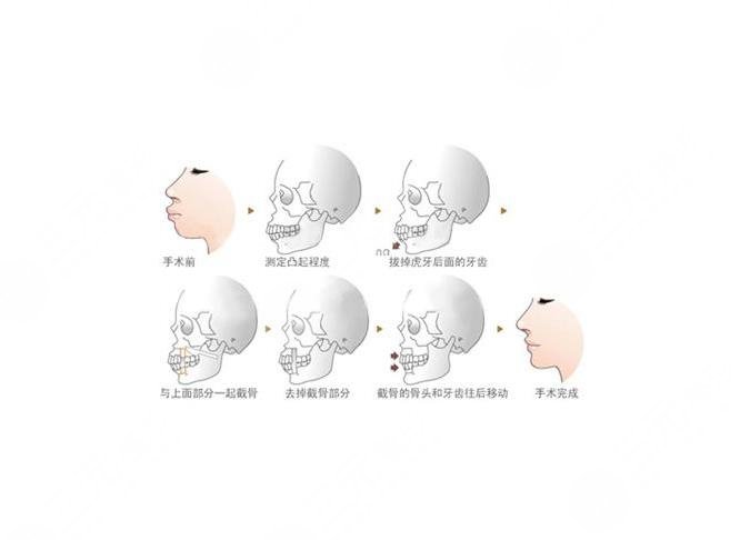 龙华中心医院口腔科正畸案例:术前
