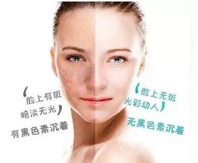 昆明祛斑医院排名前三、前五、前十榜单公布!个个实力强大,任你选择~ 昆明祛斑医院排名前三、前五、前十榜单公布!个个实力强大,任你选择~