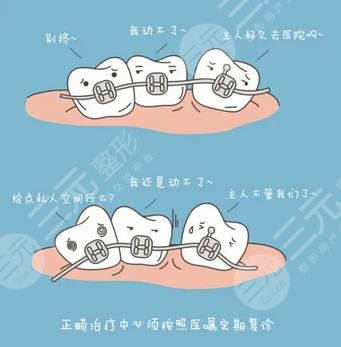 牙齿正畸