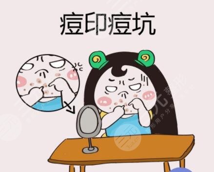 番禺中心医院激光祛痘印案例