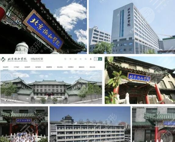 北京协和医院