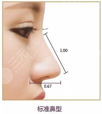 广州珠江医院整形美容中心隆鼻案例
