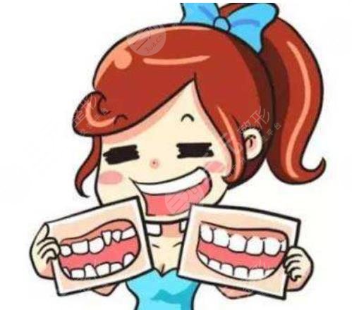南方医科大学南方医院牙齿正畸案例