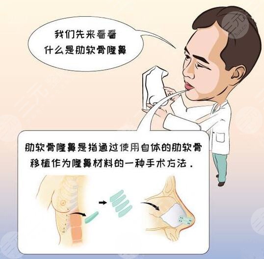 武汉五洲医院隆鼻案例