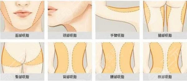 北京吸脂手术医院排名前五公开!联合丽格、协和等强势上榜|口碑实力兼备! 北京吸脂手术医院排名前五公开!联合丽格、协和等强势上榜|口碑实力兼备!