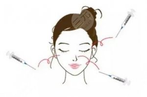 宁波有哪些正规的整形医院?排名前五榜单公布|5家医院实力雄厚,各有特色 宁波有哪些正规的整形医院?排名前五榜单公布|5家医院实力雄厚,各有特色